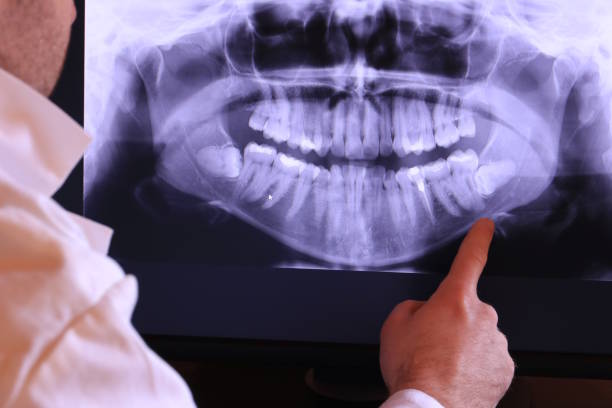 Best Emergency Dental Care for Abscessed Tooth in Broxton, GA