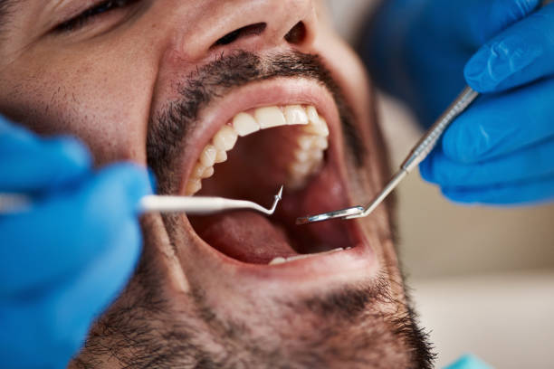 Best Pediatric Emergency Dentist in Broxton, GA