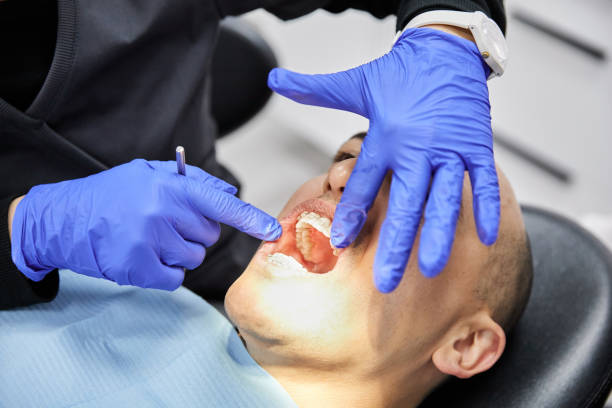 Best Broken or Cracked Tooth Emergency Dentist in Broxton, GA