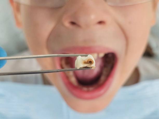 Best Orthodontic Emergency Dentist in Broxton, GA