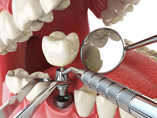 Best Emergency Dental Services for Seniors in Broxton, GA